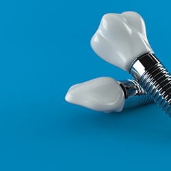 Dental implant on a blue background