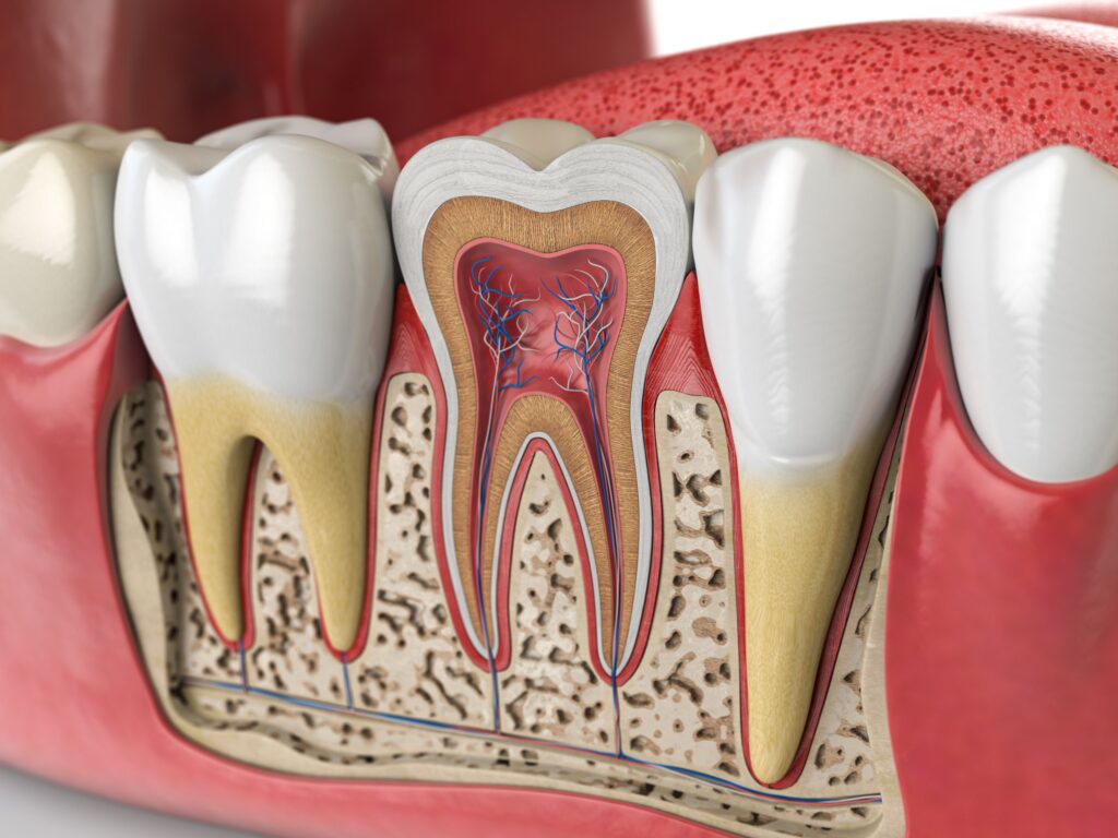 Cutaway rendering of a tooth in a lower jaw that shows the nerves